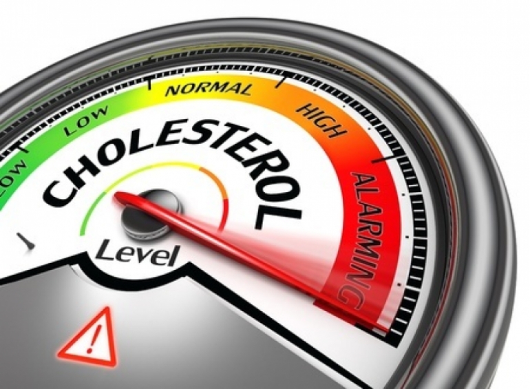 Colesterolo LDL, HDL: quando e perchè misurarlo